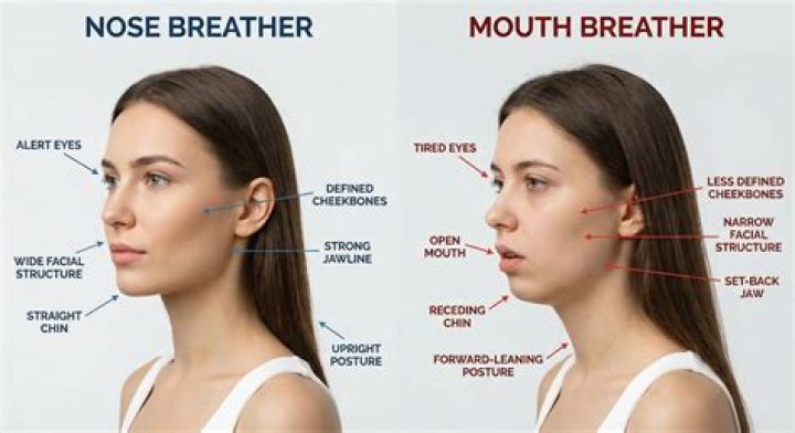 Does Mouth Breathing Cause Bad Jawline: A Comprehensive Guide